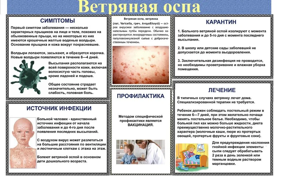 Профилактика ветряной оспы